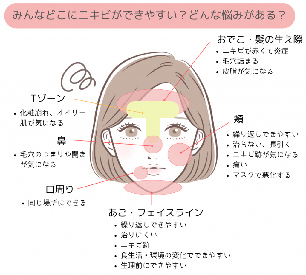 画像に alt 属性が指定されていません。ファイル名: -1024x923.png
